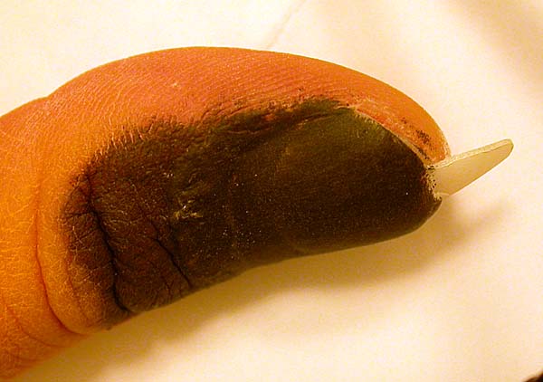 used it as part of my cat claw prosthetics as a nail bed filler used it as part of my cat claw prosthetics as a nail bed filler